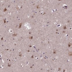 FAM181B Antibody, Novus Biologicals:Antibodies:Primary Antibodies